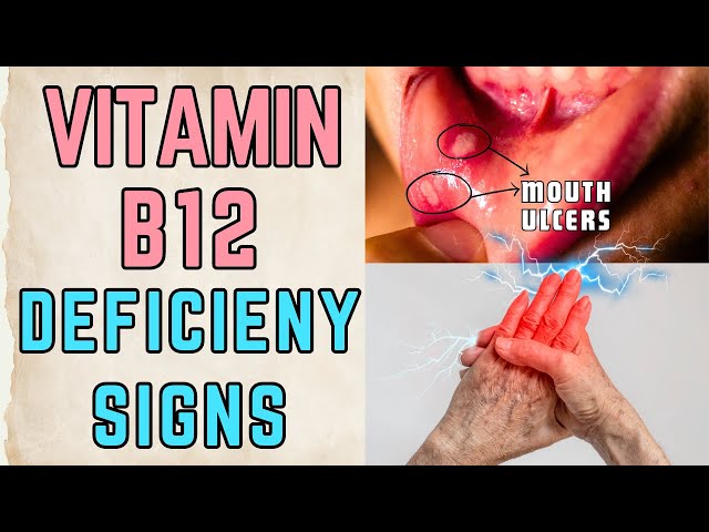 Vitamin B12 Deficiency Unveiling The Hidden Health Culprit Schooltube