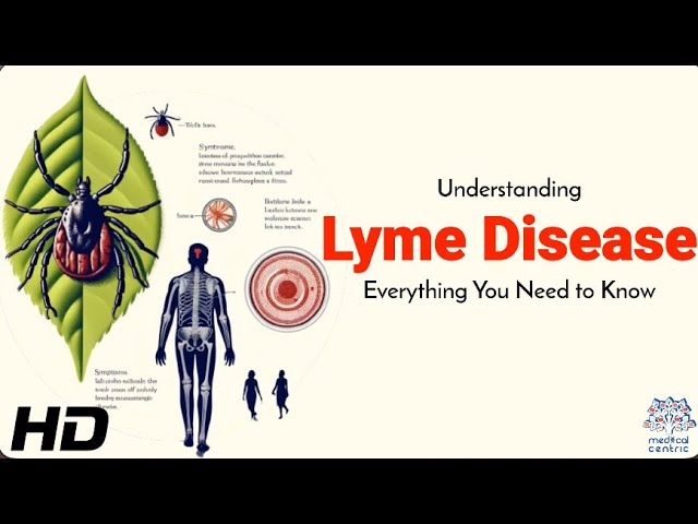 Lyme Disease: Symptoms, Causes, Diagnosis, and Treatment | SchoolTube